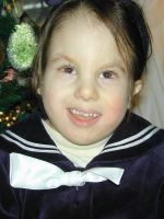 Faren, 5 years, Trisomy 18