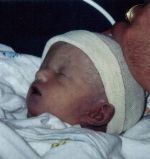 Jessica, angel, Trisomy 18