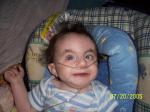 Joey, age 15 months, trisomy 18