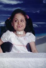 Krissy, 6 years, Trisomy 18 Mosaic