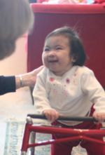 Mieko, Trisomy 18, 22 months