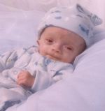 Noah, angel, Partial Trisomy 2p+