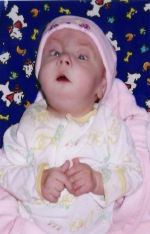 Sophie, 8 months, Trisomy 18, angel